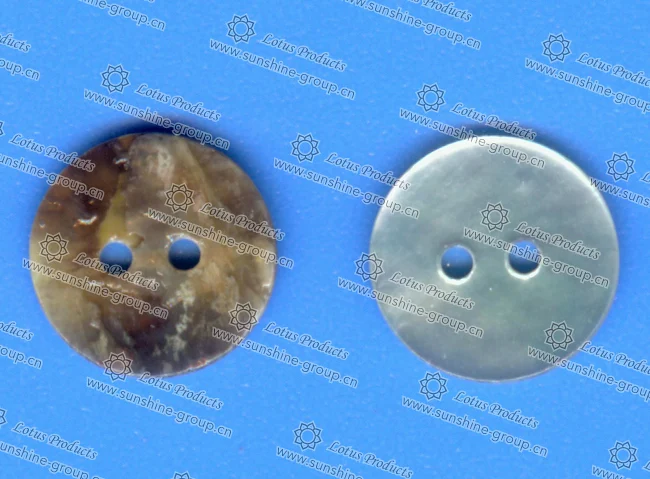 button - Ningbo Sunshine button - Ningbo Sunshine