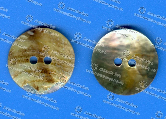 button - Ningbo Sunshine button - Ningbo Sunshine