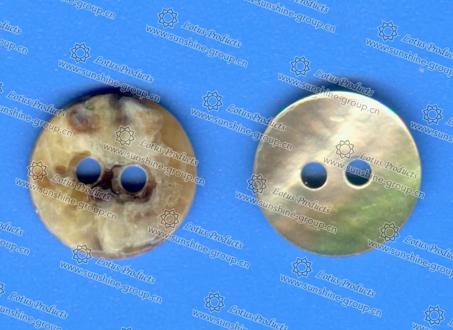 button - Ningbo Sunshine button - Ningbo Sunshine