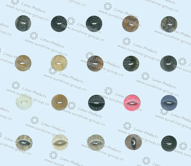 button - Ningbo Sunshine button - Ningbo Sunshine